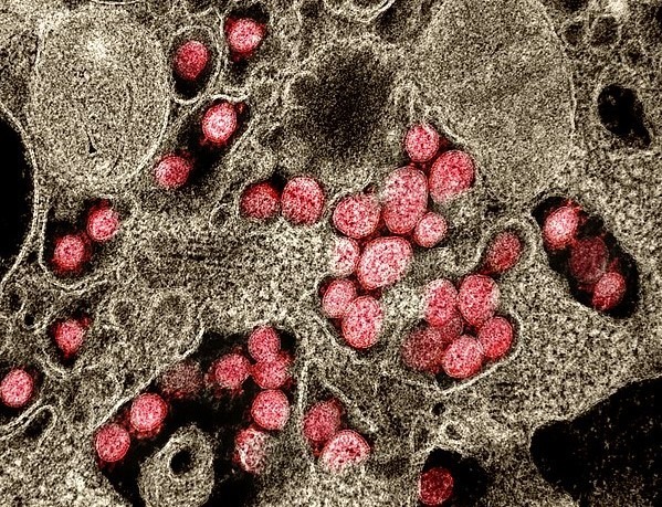 a600px-Novel_Coronavirus_SARS-CoV-2__49597020718_